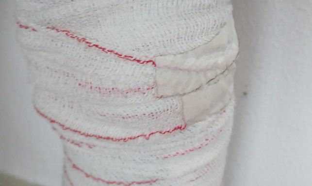 Guardia Civil lesionado