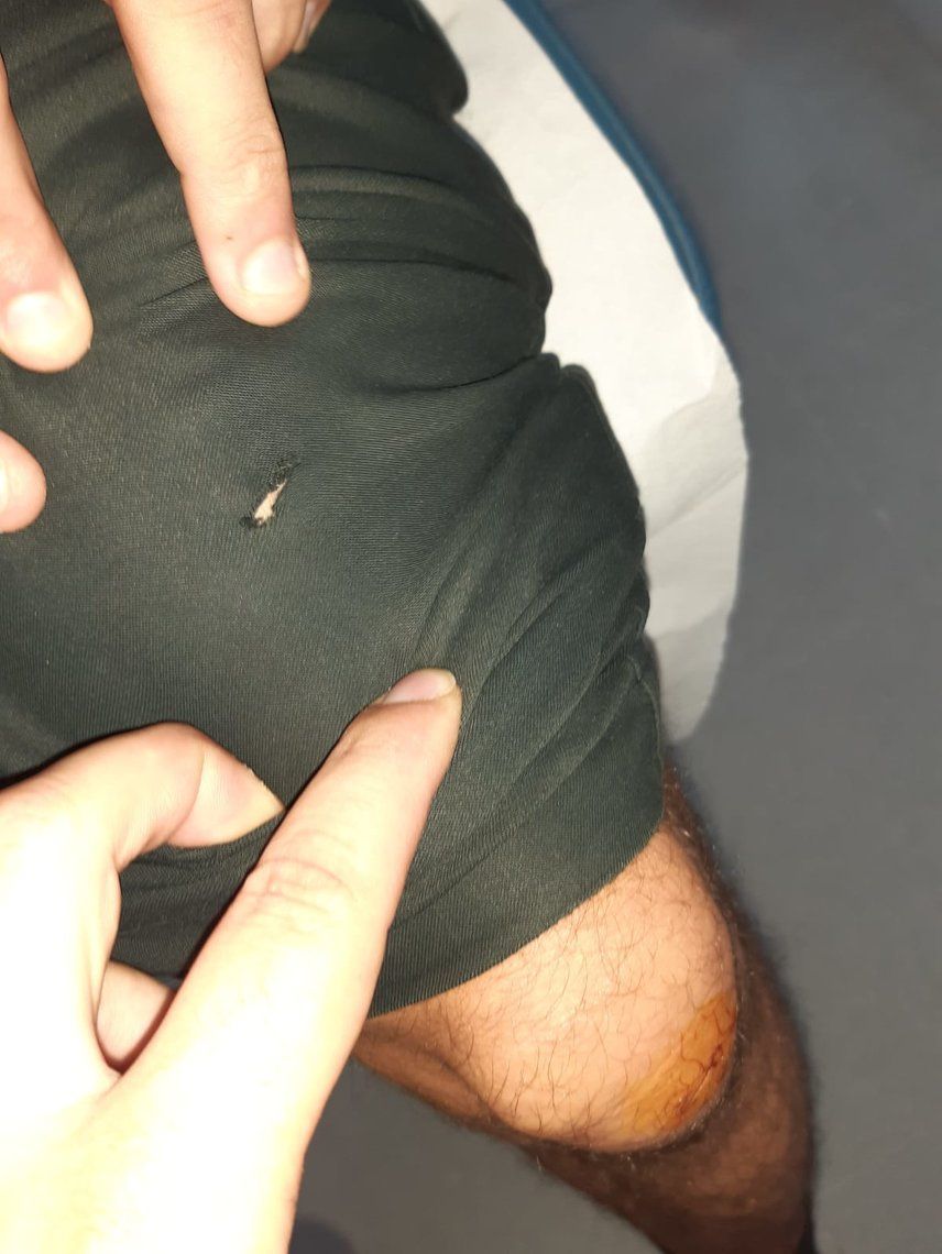 Fotografía del corte recibido en la pierna por uno de los agentes.