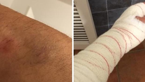 Imagen de las contusiones y heridas del agente tras la embestida. Foto ABC