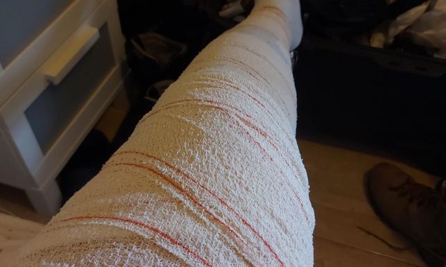 La pierna de uno de los agentes de la Guardia Civil necesitó ser vendada.